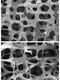 Comparison of normal and osteoporotic bone architecture