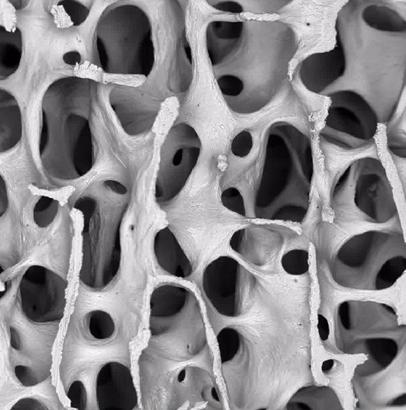 bone cells under a microscope