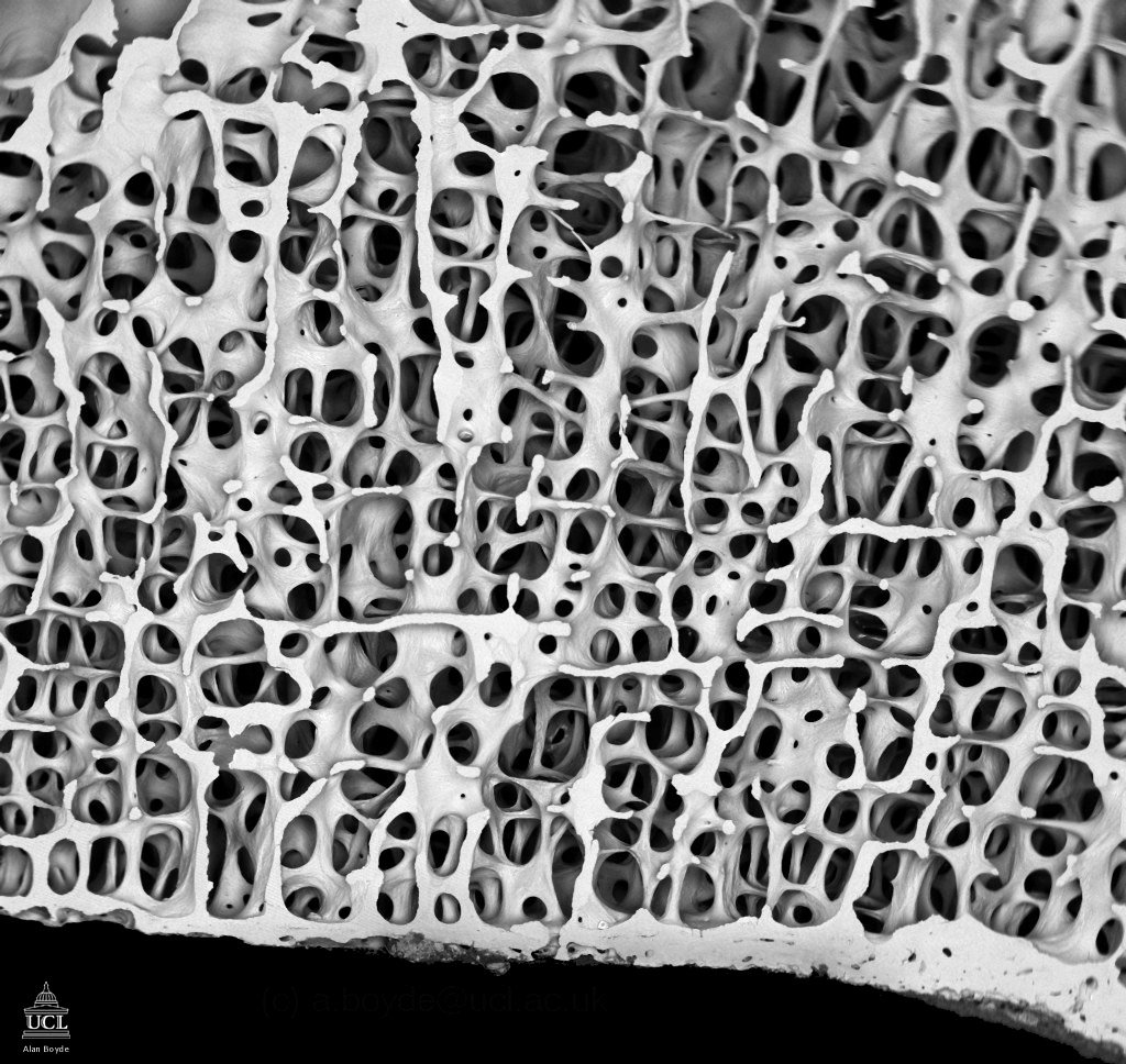 Строение кости под микроскопом