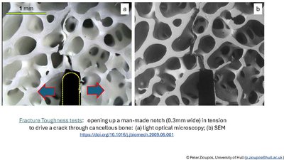 Micrographs of cracks driven through cancellous bone #1