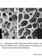 Micrographs of cracks driven through cancellous bone #1