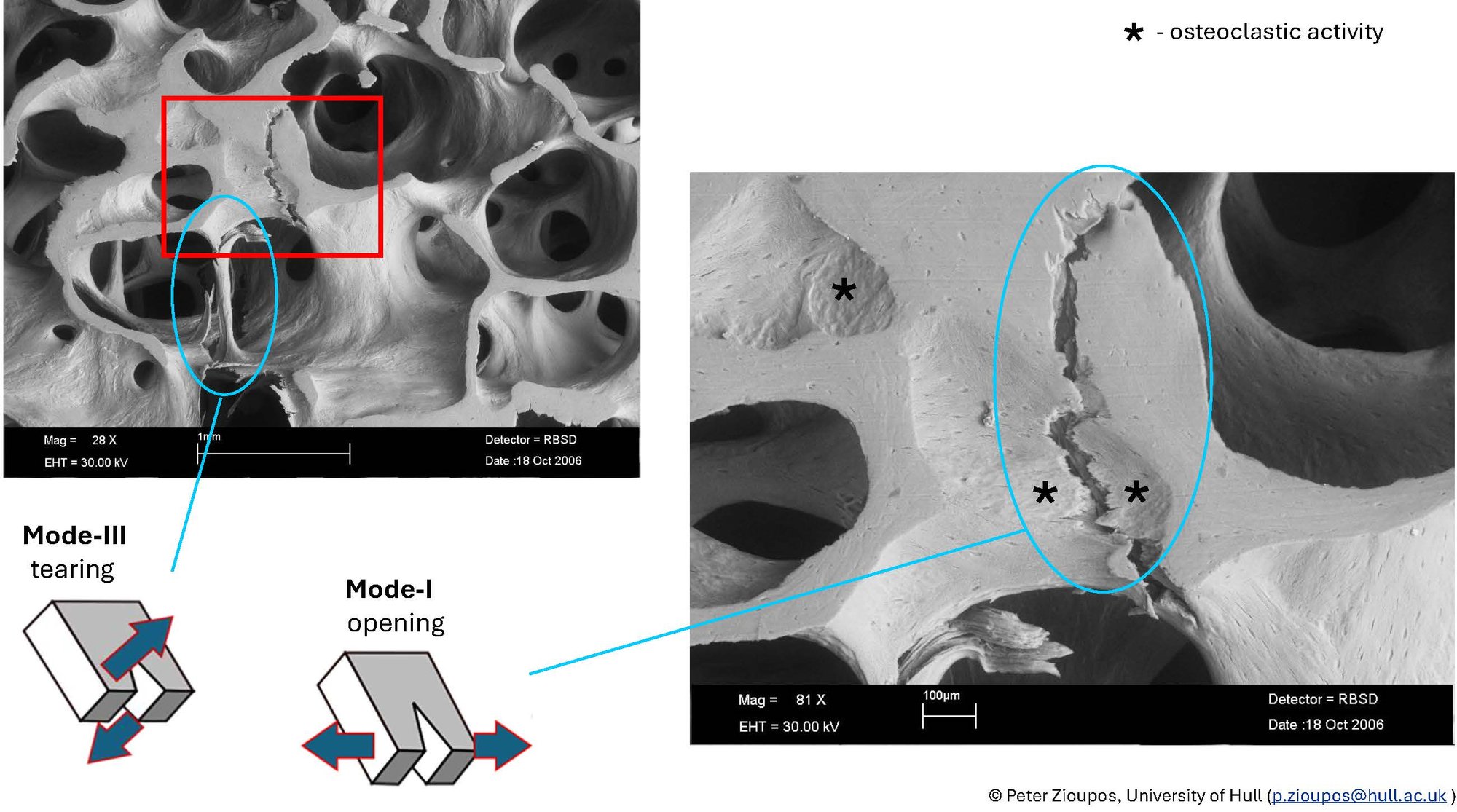 Micrographs of cracks driven through cancellous bone #4