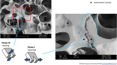Micrographs of cracks driven through cancellous bone #4