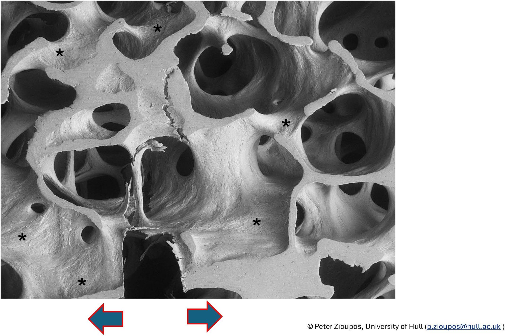 Micrographs of cracks driven through cancellous bone #5