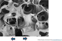 Micrographs of cracks driven through cancellous bone #5