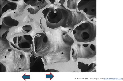Micrographs of cracks driven through cancellous bone #5